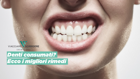 Denti consumati? Ecco i migliori rimedi