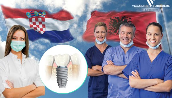 Impianti dentali in Croazia o Albania: tutto quello che devi sapere