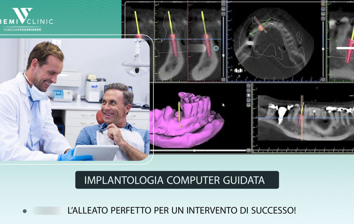 Implantologia computer guidata – l’alleato perfetto per un intervento di successo!