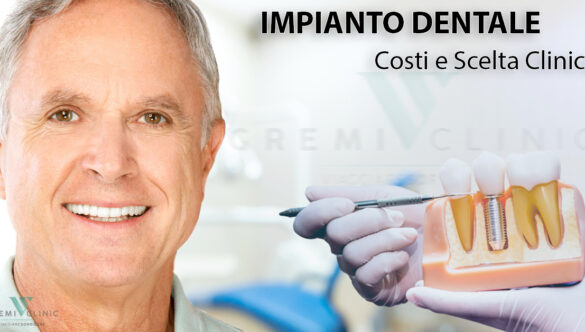 Impianto Dentale: Costi e Scelta Clinica